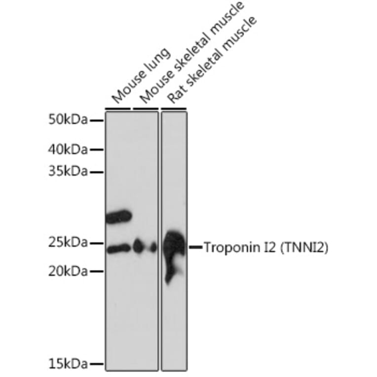 Western Blot - Anti-Troponin I fast skeletal muscle Antibody [ARC1114] (A305831) - Antibodies.com