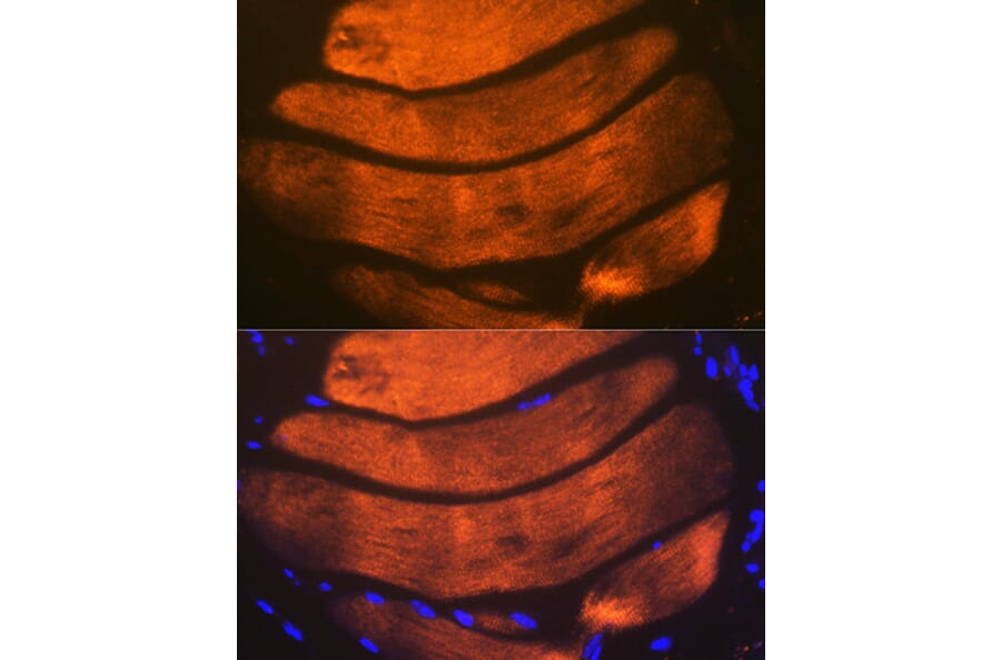 Immunofluorescence - Anti-Troponin I fast skeletal muscle Antibody [ARC1114] (A305831) - Antibodies.com