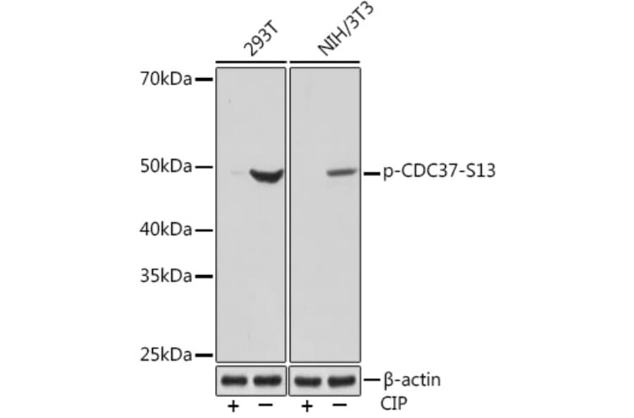 Western Blot - Anti-Cdc37 (phospho Ser13) Antibody [ARC1602] (A305832) - Antibodies.com