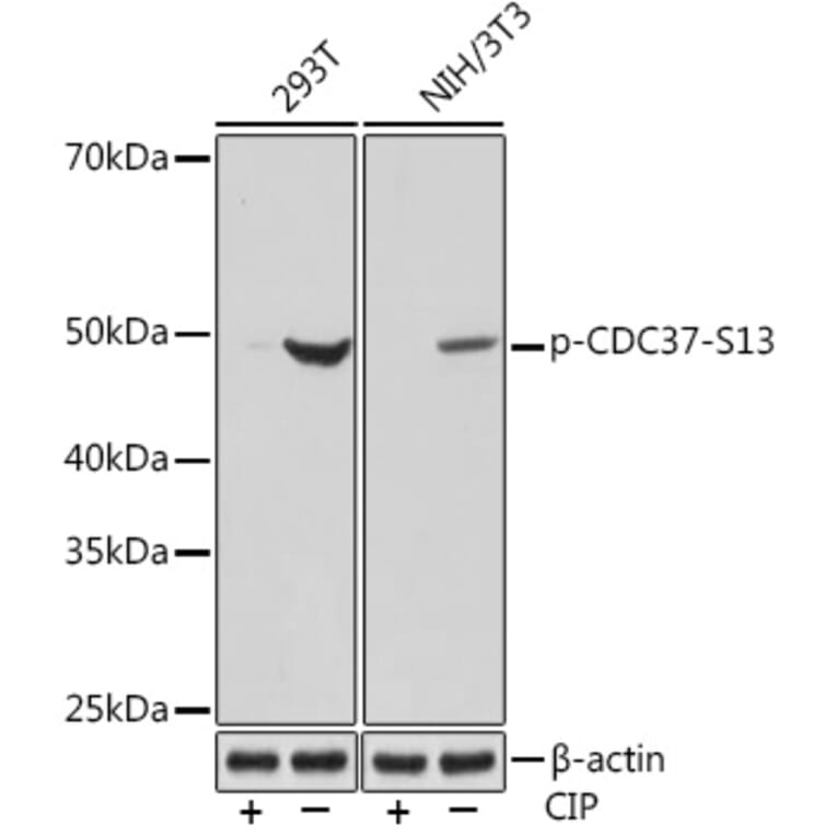 Western Blot - Anti-Cdc37 (phospho Ser13) Antibody [ARC1602] (A305832) - Antibodies.com