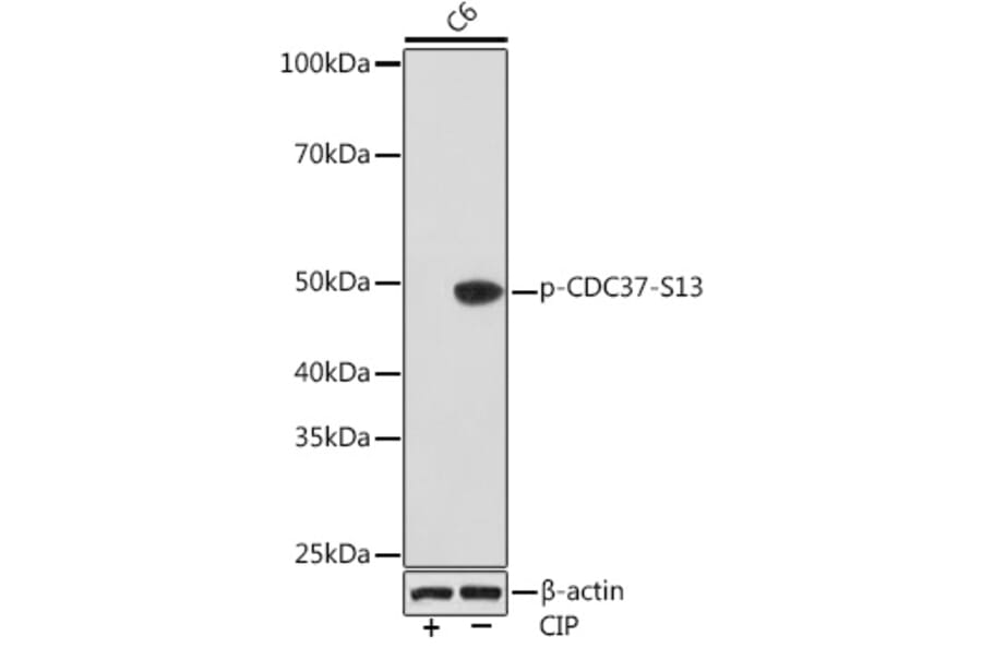 Western Blot - Anti-Cdc37 (phospho Ser13) Antibody [ARC1602] (A305832) - Antibodies.com