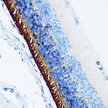 Immunohistochemistry - Anti-Rhodopsin Antibody [ARC1818] (A305833) - Antibodies.com