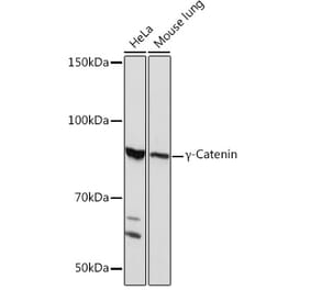 Western Blot - Anti-gamma Catenin Antibody [ARC0909] (A305834) - Antibodies.com