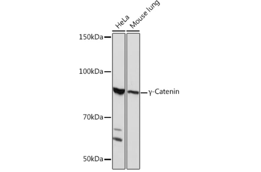 Western Blot - Anti-gamma Catenin Antibody [ARC0909] (A305834) - Antibodies.com