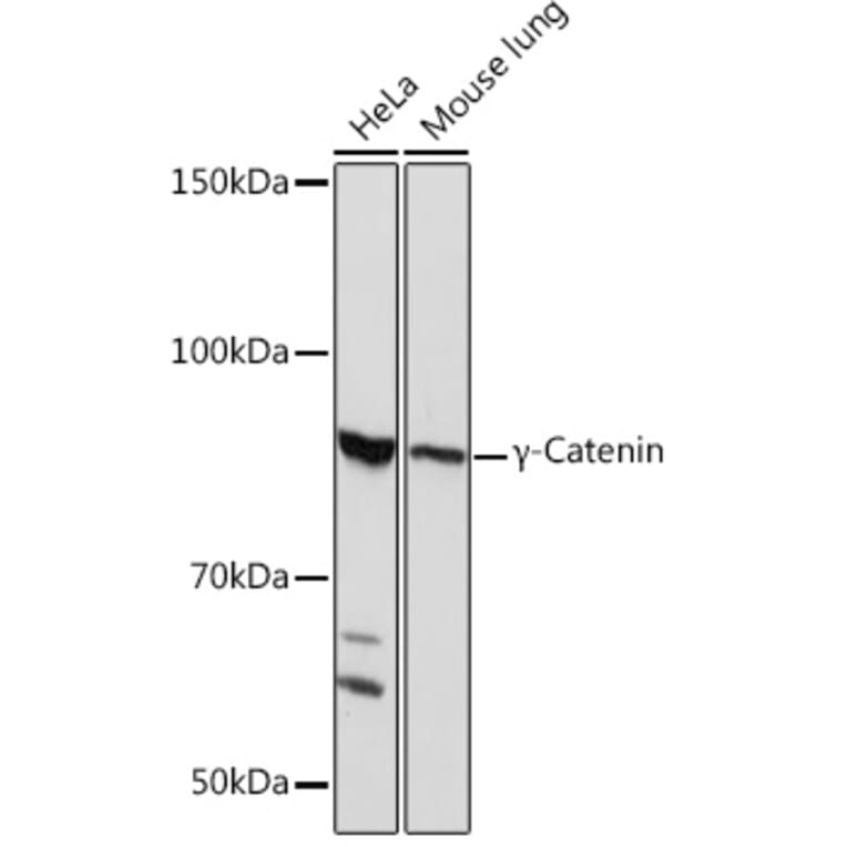 Western Blot - Anti-gamma Catenin Antibody [ARC0909] (A305834) - Antibodies.com