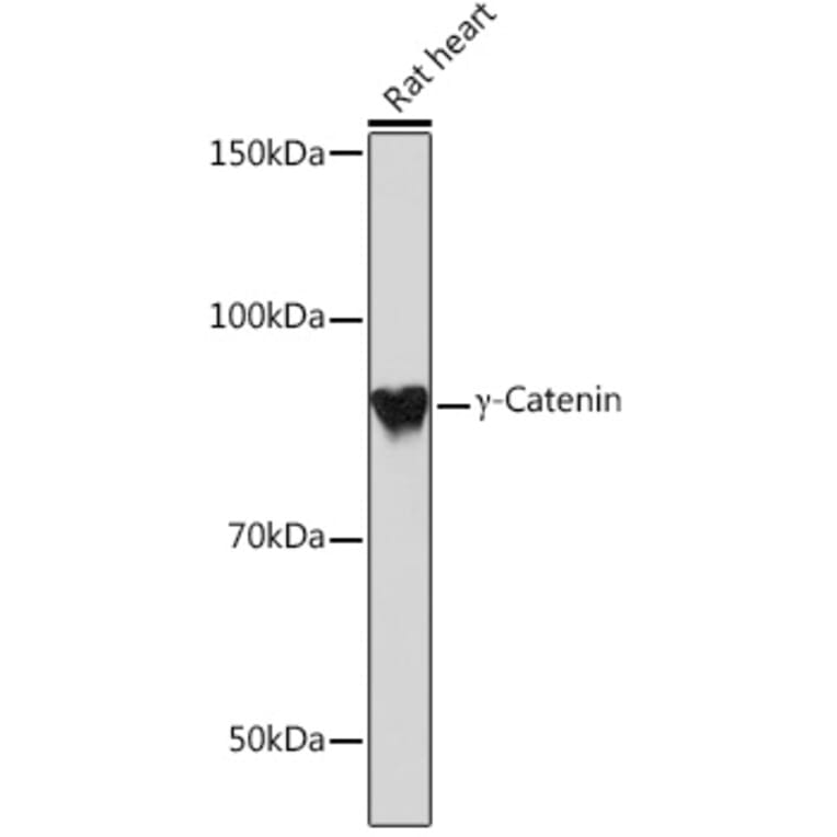 Western Blot - Anti-gamma Catenin Antibody [ARC0909] (A305834) - Antibodies.com