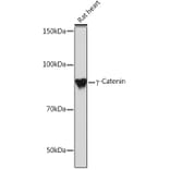 Western Blot - Anti-gamma Catenin Antibody [ARC0909] (A305834) - Antibodies.com