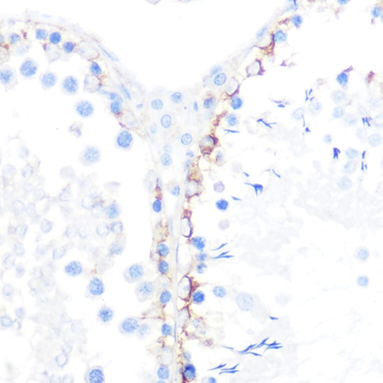 Immunohistochemistry - Anti-gamma Catenin Antibody [ARC0909] (A305834) - Antibodies.com