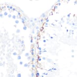 Immunohistochemistry - Anti-gamma Catenin Antibody [ARC0909] (A305834) - Antibodies.com