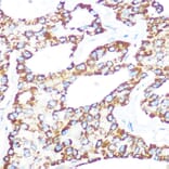 Immunohistochemistry - Anti-gamma Catenin Antibody [ARC0909] (A305834) - Antibodies.com