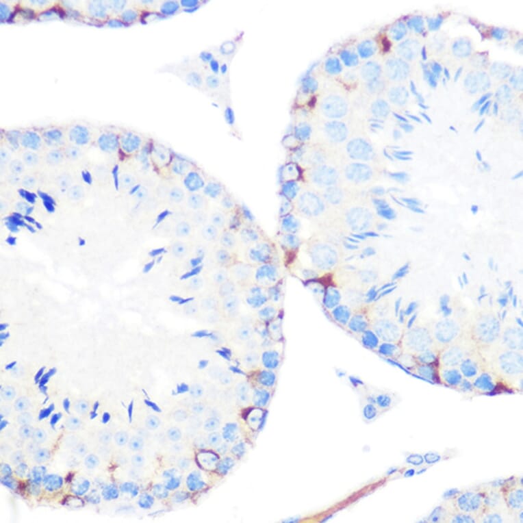 Immunohistochemistry - Anti-gamma Catenin Antibody [ARC0909] (A305834) - Antibodies.com