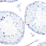 Immunohistochemistry - Anti-gamma Catenin Antibody [ARC0909] (A305834) - Antibodies.com