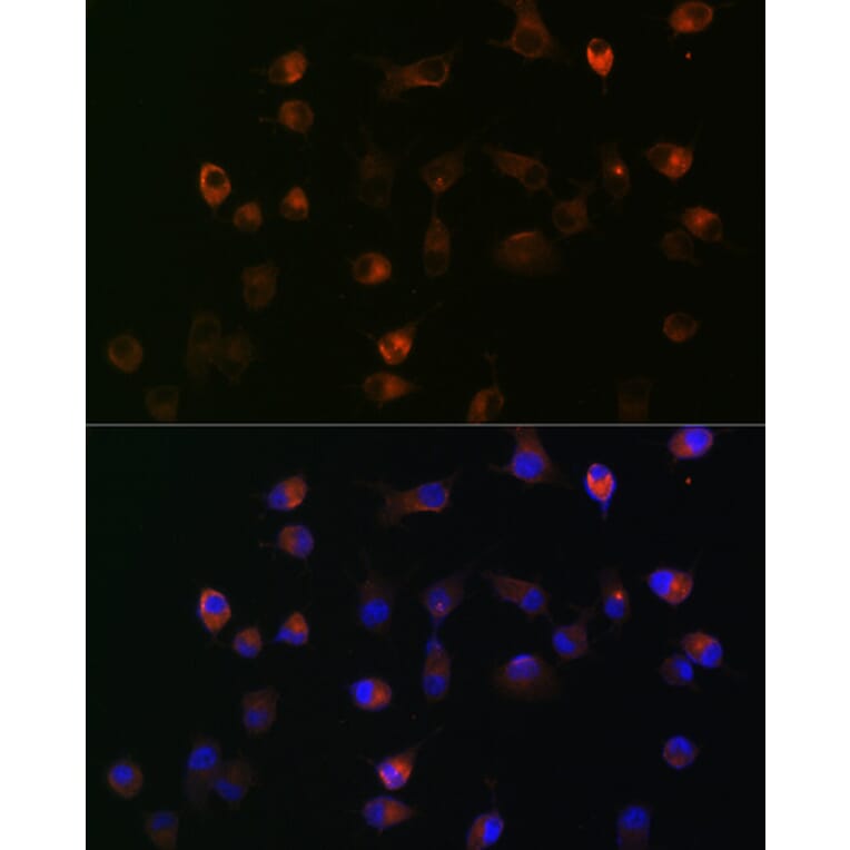 Immunofluorescence - Anti-gamma Catenin Antibody [ARC0909] (A305834) - Antibodies.com