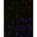 Immunofluorescence - Anti-gamma Catenin Antibody [ARC0909] (A305834) - Antibodies.com