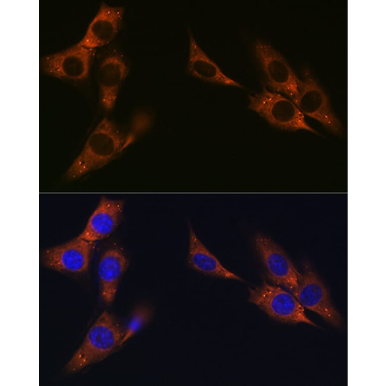 Immunofluorescence - Anti-gamma Catenin Antibody [ARC0909] (A305834) - Antibodies.com