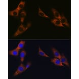 Immunofluorescence - Anti-gamma Catenin Antibody [ARC0909] (A305834) - Antibodies.com