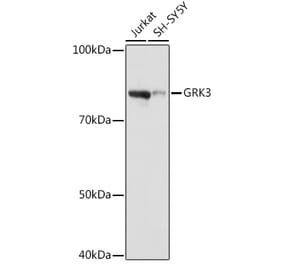 Western Blot - Anti-GRK3 Antibody [ARC1458] (A305835) - Antibodies.com