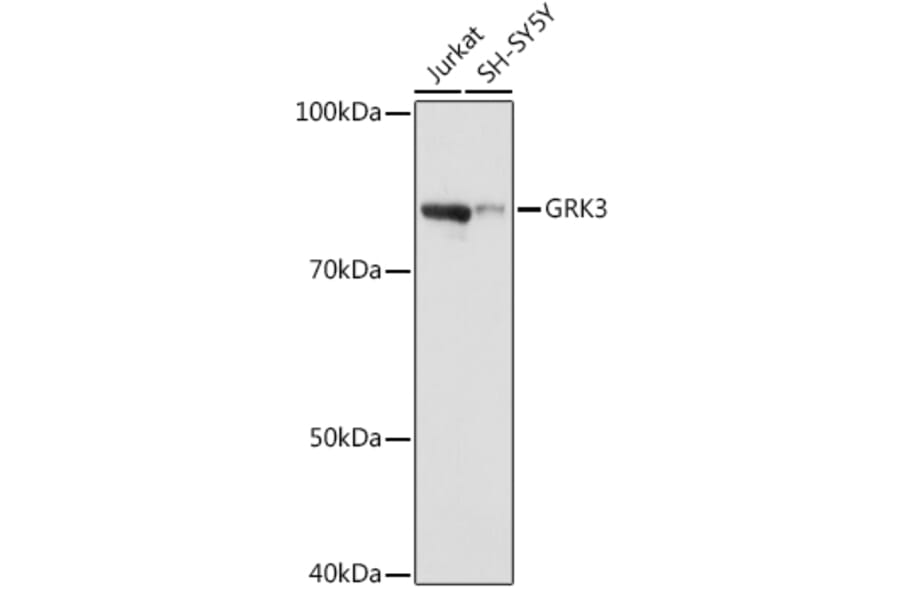Western Blot - Anti-GRK3 Antibody [ARC1458] (A305835) - Antibodies.com