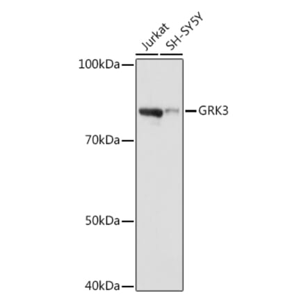 Western Blot - Anti-GRK3 Antibody [ARC1458] (A305835) - Antibodies.com