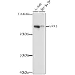 Western Blot - Anti-GRK3 Antibody [ARC1458] (A305835) - Antibodies.com