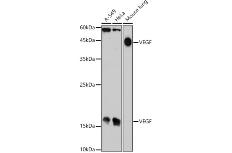 Western Blot - Anti-VEGFA Antibody (A305836) - Antibodies.com