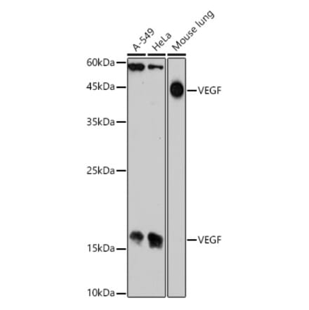 Western Blot - Anti-VEGFA Antibody (A305836) - Antibodies.com