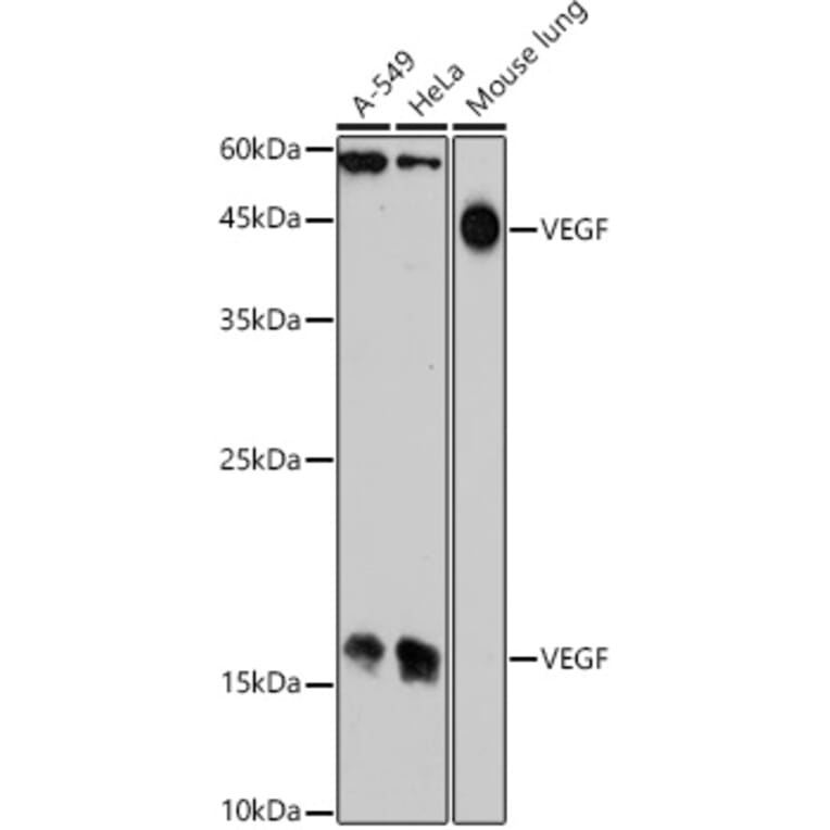 Western Blot - Anti-VEGFA Antibody (A305836) - Antibodies.com