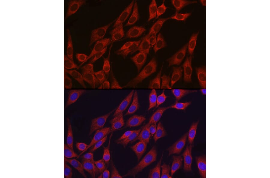 Immunofluorescence - Anti-VEGFA Antibody (A305836) - Antibodies.com