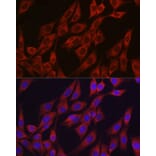 Immunofluorescence - Anti-VEGFA Antibody (A305836) - Antibodies.com