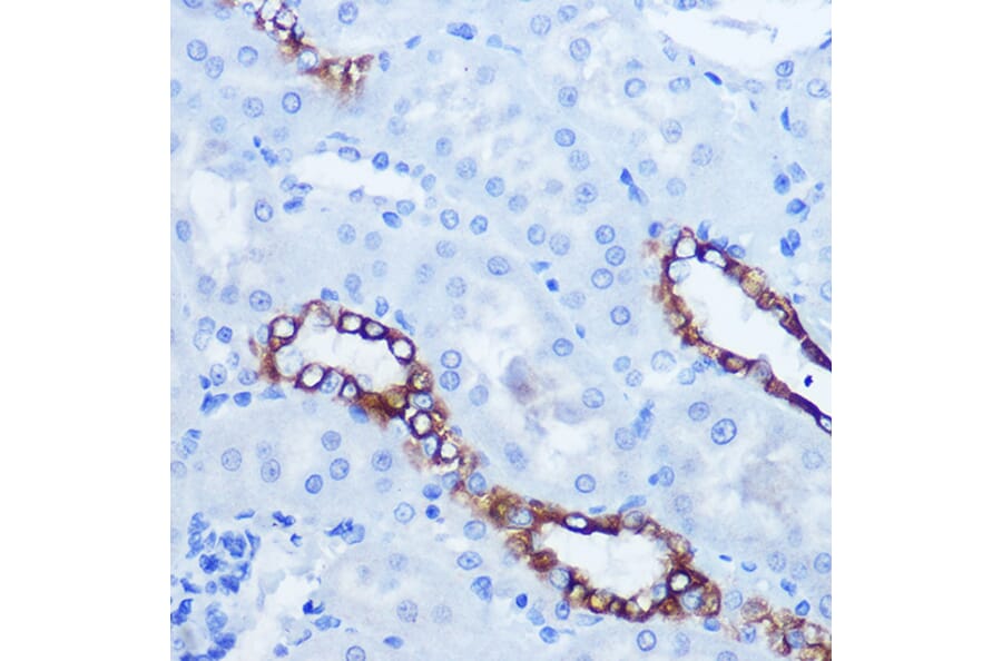 Immunohistochemistry - Anti-Eph receptor A3 + Eph Receptor A4 + Eph Receptor A5 Antibody (A305837) - Antibodies.com