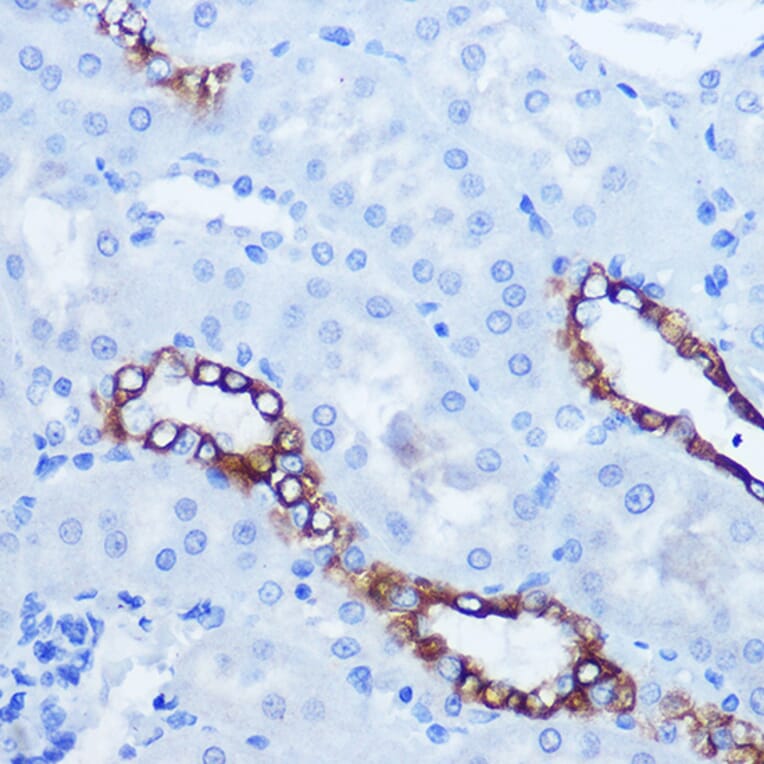 Immunohistochemistry - Anti-Eph receptor A3 + Eph Receptor A4 + Eph Receptor A5 Antibody (A305837) - Antibodies.com