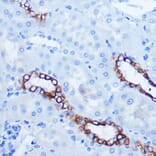 Immunohistochemistry - Anti-Eph receptor A3 + Eph Receptor A4 + Eph Receptor A5 Antibody (A305837) - Antibodies.com