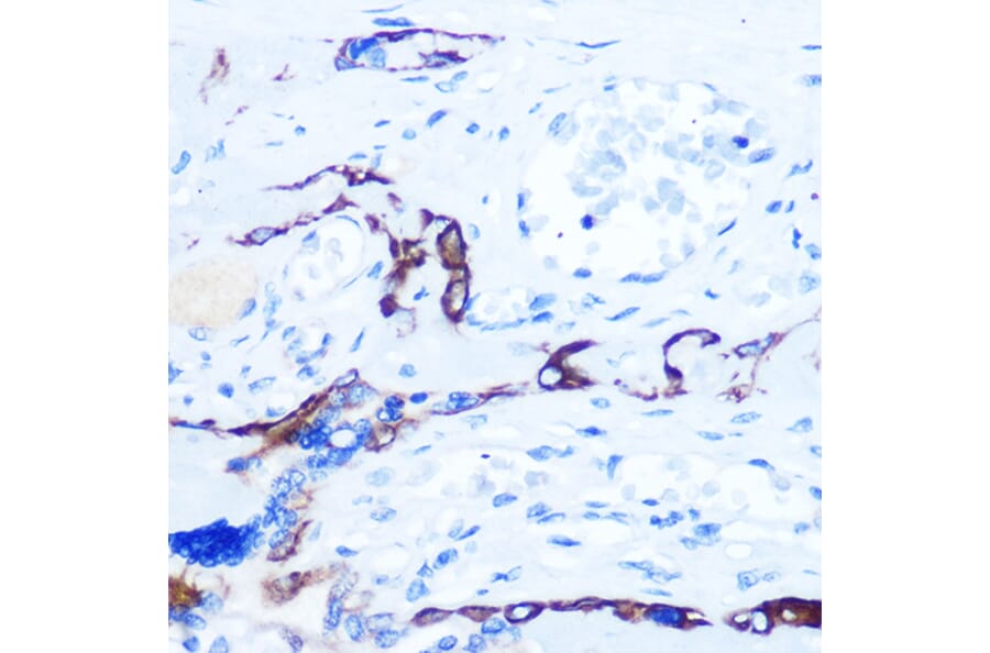 Immunohistochemistry - Anti-Eph receptor A3 + Eph Receptor A4 + Eph Receptor A5 Antibody (A305837) - Antibodies.com