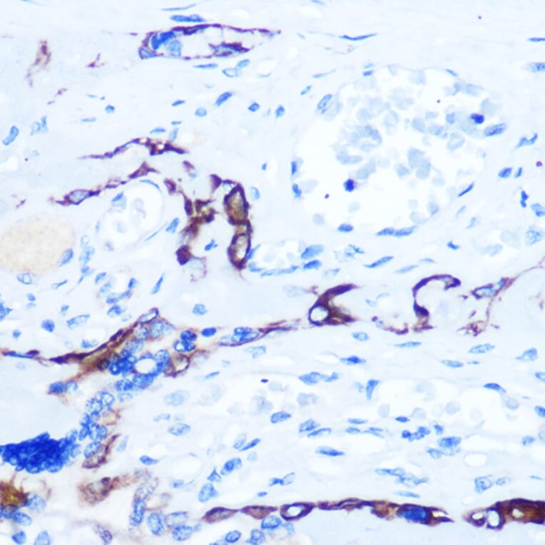 Immunohistochemistry - Anti-Eph receptor A3 + Eph Receptor A4 + Eph Receptor A5 Antibody (A305837) - Antibodies.com