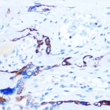 Immunohistochemistry - Anti-Eph receptor A3 + Eph Receptor A4 + Eph Receptor A5 Antibody (A305837) - Antibodies.com