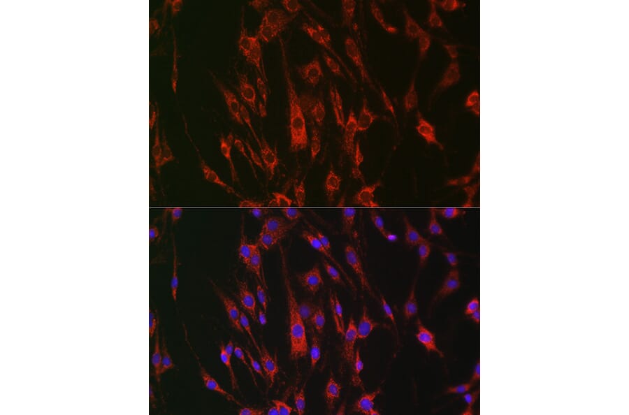 Immunofluorescence - Anti-Eph receptor A3 + Eph Receptor A4 + Eph Receptor A5 Antibody (A305837) - Antibodies.com