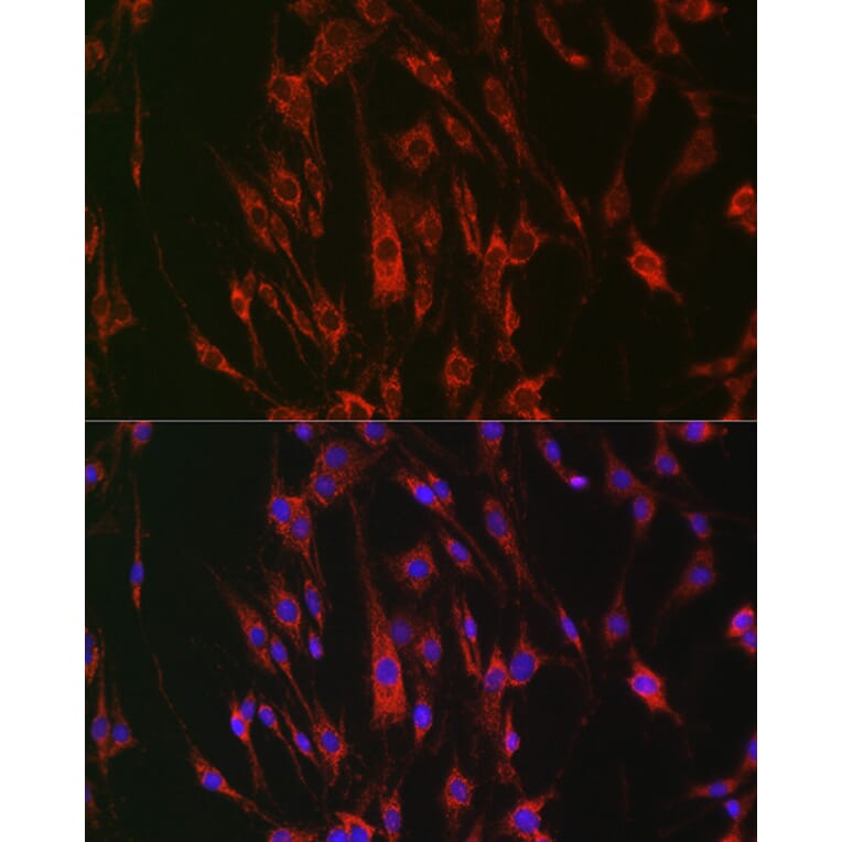 Immunofluorescence - Anti-Eph receptor A3 + Eph Receptor A4 + Eph Receptor A5 Antibody (A305837) - Antibodies.com
