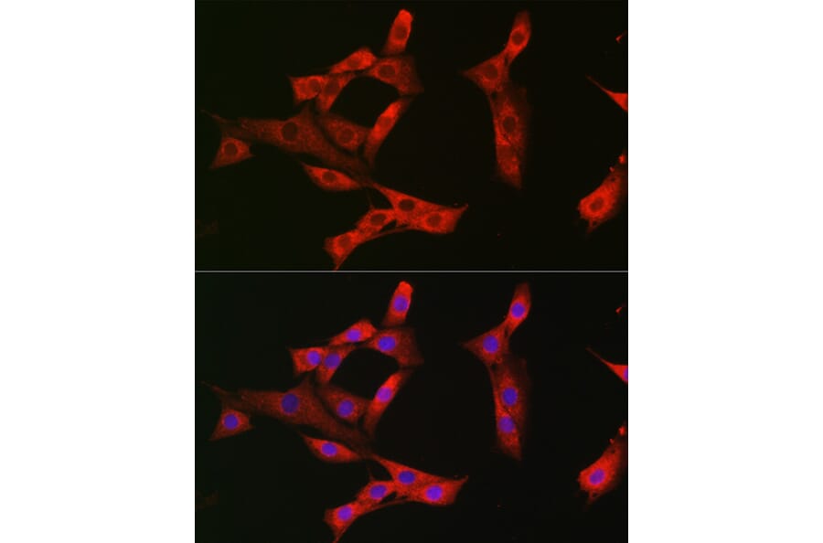 Immunofluorescence - Anti-Eph receptor A3 + Eph Receptor A4 + Eph Receptor A5 Antibody (A305837) - Antibodies.com