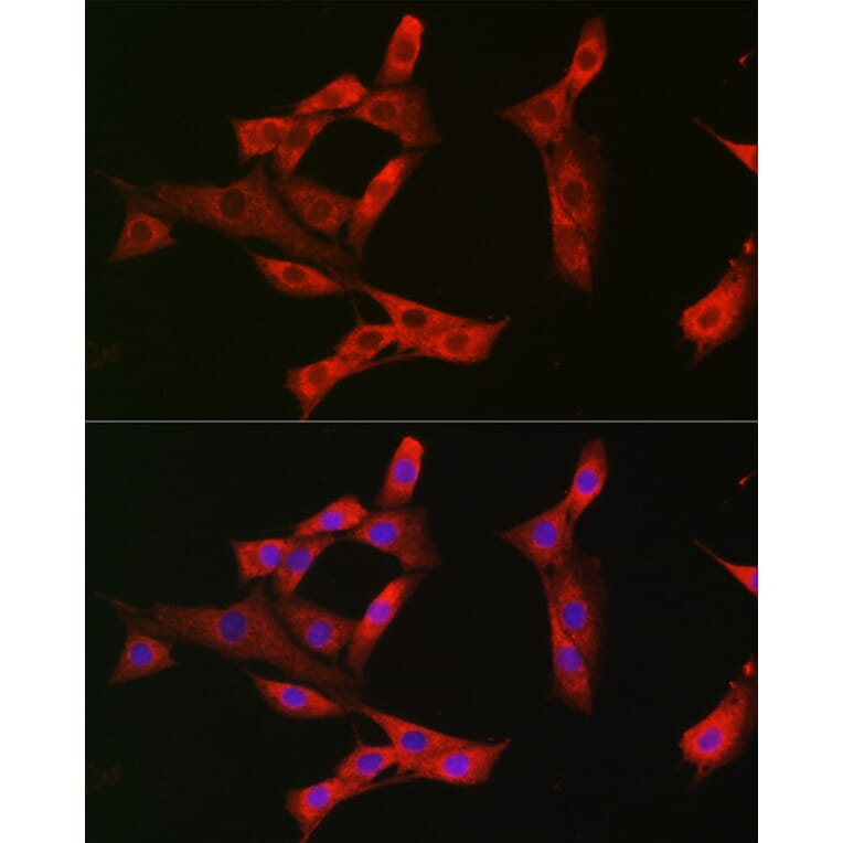 Immunofluorescence - Anti-Eph receptor A3 + Eph Receptor A4 + Eph Receptor A5 Antibody (A305837) - Antibodies.com