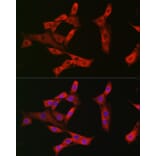 Immunofluorescence - Anti-Eph receptor A3 + Eph Receptor A4 + Eph Receptor A5 Antibody (A305837) - Antibodies.com