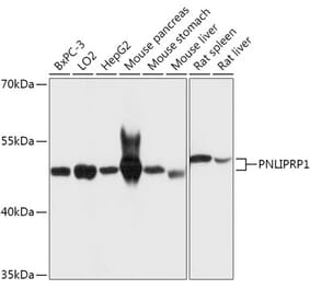 Western Blot - Anti-PNLIPRP1 Antibody (A305839) - Antibodies.com