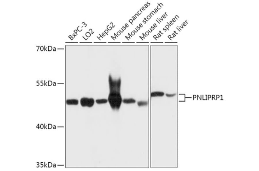 Western Blot - Anti-PNLIPRP1 Antibody (A305839) - Antibodies.com