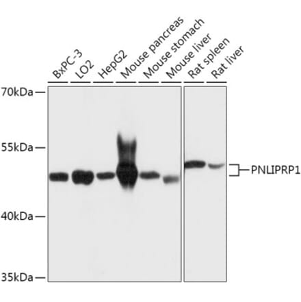 Western Blot - Anti-PNLIPRP1 Antibody (A305839) - Antibodies.com