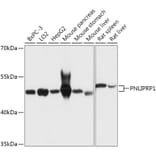 Western Blot - Anti-PNLIPRP1 Antibody (A305839) - Antibodies.com
