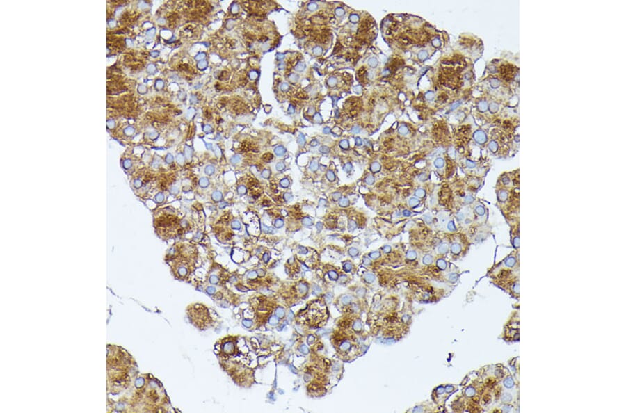 Immunohistochemistry - Anti-PNLIPRP1 Antibody (A305839) - Antibodies.com