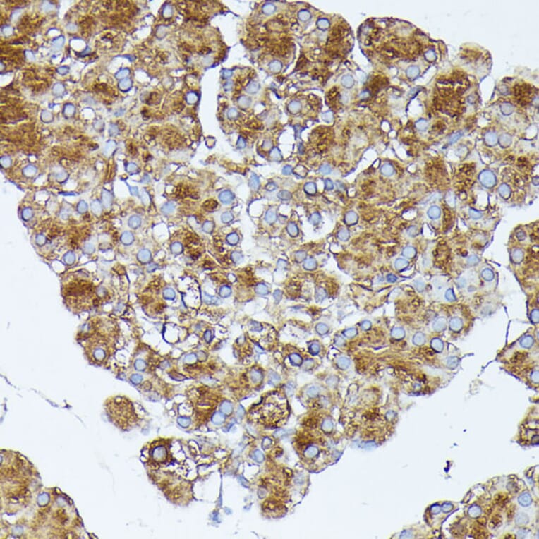 Immunohistochemistry - Anti-PNLIPRP1 Antibody (A305839) - Antibodies.com