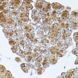 Immunohistochemistry - Anti-PNLIPRP1 Antibody (A305839) - Antibodies.com