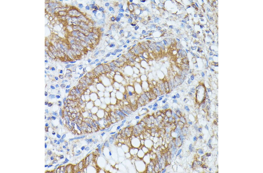 Immunohistochemistry - Anti-PNLIPRP1 Antibody (A305839) - Antibodies.com