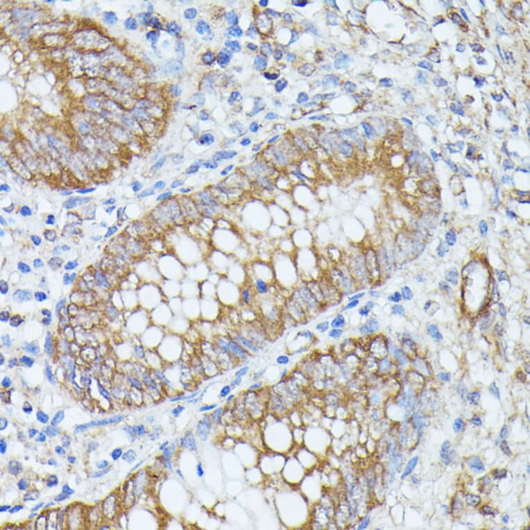 Immunohistochemistry - Anti-PNLIPRP1 Antibody (A305839) - Antibodies.com