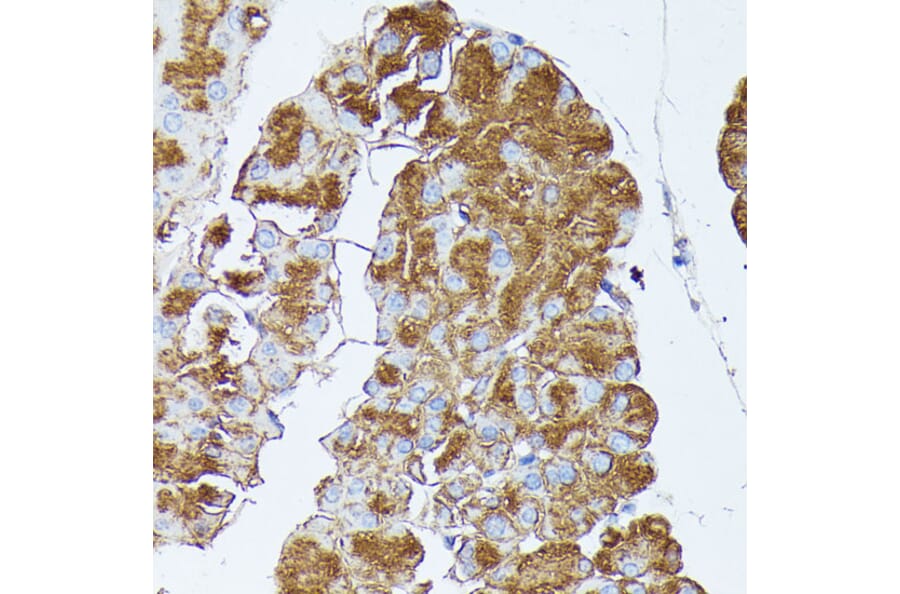 Immunohistochemistry - Anti-PNLIPRP1 Antibody (A305839) - Antibodies.com